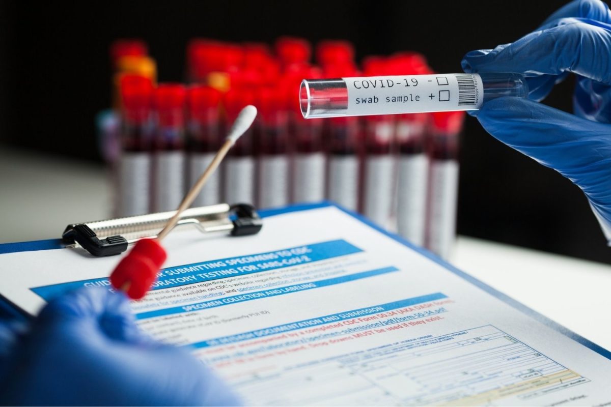 Pathcare agrees to drop Covid19 PCR test prices immediately