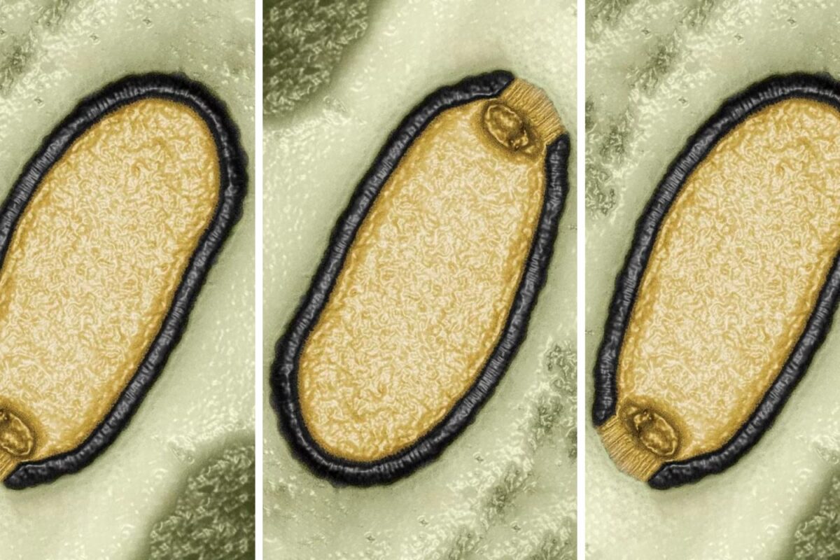 Thawed 50 000yearold zombie virus poses health threat