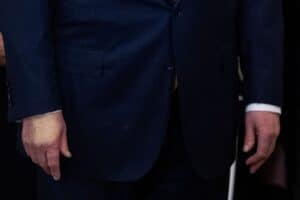 Trump diagnosed with vein issue after leg swelling and hand bruising