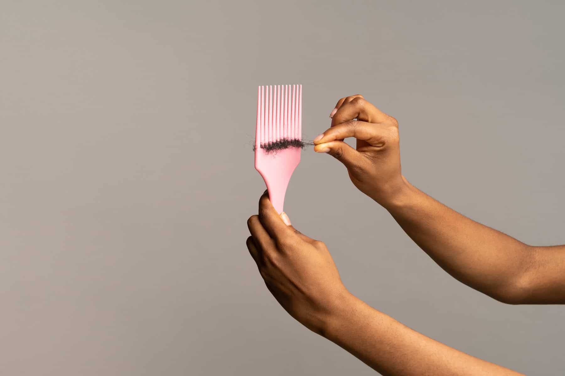 Hair loss, Picture Istock