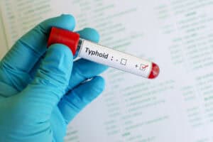 No typhoid found in Tshwane’s water supply