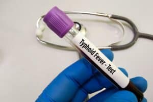 Gauteng Health warns of Typhoid Fever: Here are the symptoms