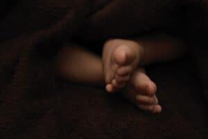 Newborn conjoined twins born in Limpopo are in stable condition