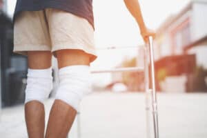 south africa, knee prosthetics, first ever manufactured, health, amputee