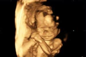 Backing Middelburg's baby Lumieke.