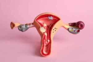 HIV positive women fight for justice after sterilisation