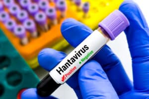 SA traces 91 of 97 contacts in deadly hantavirus outbreak
