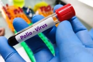 JUST IN: NICD detects two polio virus strains in Cape Town wastewater