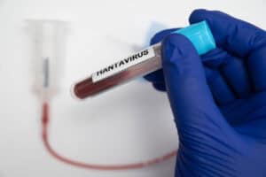France and Netherlands say all hantavirus contact cases negative