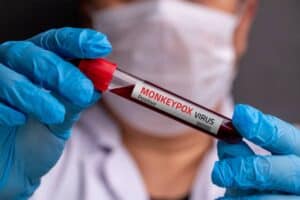 South Africa's mpox numbers are creeping up: Here Is What You Need to Know