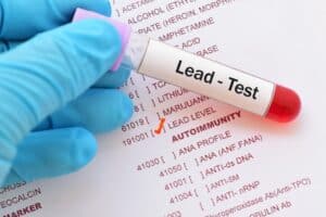 Gauteng Health urges communities to take precautions against lead poisoning