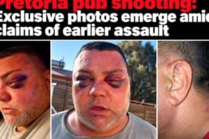Photos supplied to Rekord reportedly show Pretoria pub shooting accused Brian Wesley Smith’s injuries following an alleged earlier assault.